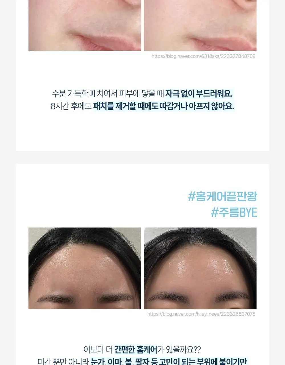[OY단독] 라보타치 미간 케어 패치 18매 상세페이지 5